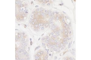Immunohistochemistry (IHC) image for anti-Protein Tyrosine Phosphatase G1 (PTPN12) (AA 499-780) antibody (ABIN7453983)