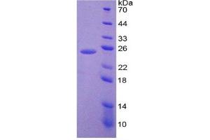 SDS-PAGE of Protein Standard from the Kit  (Highly purified E. (IL-6 Kit ELISA)
