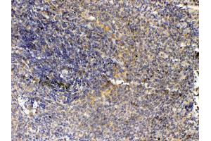 IHC analysis of Thrombopoietin using anti- Thrombopoietin antibody .