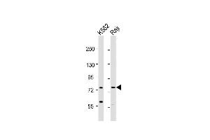 All lanes : Anti-ABCB10 Antibody (S16) at 1:1000-1:2000 dilution Lane 1: K562 whole cell lysates Lane 2: Raji whole cell lysates Lysates/proteins at 20 μg per lane.