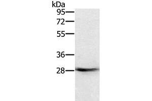 Western Blot analysis of Human normal colon tissue using RAB8B Polyclonal Antibody at dilution of 1:400 (RAB8B anticorps)