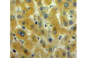 Used in DAB staining on fromalin fixed paraffin-embedded Liver tissue (CAMKII gamma anticorps  (AA 75-281))