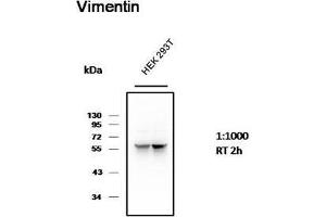 Western Blot (WB) analysis of 293T cell with Mouse Monoclonal Antibody diluted at 1:1000. (Vimentin anticorps)