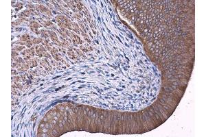 IHC-P Image FAK antibody detects FAK protein at cytoplasm in rat cervix by immunohistochemical analysis.