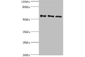 Western blot All lanes: Serine/threonine-protein phosphatase 2B catalytic subunit gamma isoform antibody at 10 μg/mL Lane 1: Rat brain tissue Lane 2: MCF-7 whole cell lysate Lane 3: Rat skeletal muscle tissue Secondary Goat polyclonal to rabbit IgG at 1/10000 dilution Predicted band size: 59, 58, 60 kDa Observed band size: 59 kDa