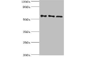 Western blot All lanes: Serine/threonine-protein phosphatase 2B catalytic subunit gamma isoform antibody at 10 μg/mL Lane 1: Rat brain tissue Lane 2: MCF-7 whole cell lysate Lane 3: Rat skeletal muscle tissue Secondary Goat polyclonal to rabbit IgG at 1/10000 dilution Predicted band size: 59, 58, 60 kDa Observed band size: 59 kDa (PPP3CC anticorps  (Catalytic Subunit gamma))