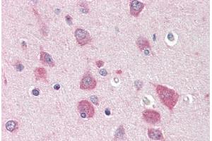 Human Brain, Cortex (formalin-fixed, paraffin-embedded) stained with MYO5B antibody ABIN396915 at 20 ug/ml followed by biotinylated goat anti-rabbit IgG secondary antibody ABIN481713, alkaline phosphatase-streptavidin and chromogen. (MYO5B anticorps  (C-Term))