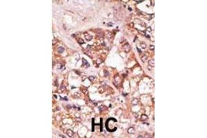 Immunohistochemistry (IHC) image for anti-BCL2-Interacting Killer (Apoptosis-Inducing) (BIK) (BH3 Domain) antibody (ABIN2997206)