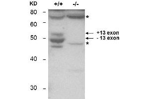 Western Blotting (WB) image for anti-Bridging Integrator 1 (BIN1) antibody (ABIN1043739) (BIN1 anticorps)
