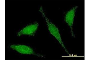 Immunofluorescence of purified MaxPab antibody to C6orf206 on HeLa cell. (RSPH9 anticorps  (AA 1-276))