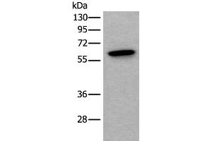 Western blot analysis of Mouse testis tissue lysate using SCP2 Polyclonal Antibody at dilution of 1:350 (SCP2 anticorps)