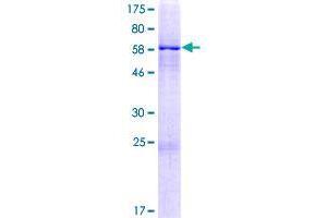 Image no. 1 for Zinc Finger Protein interacting with Ribonucleoprotein K (ZIK1) (AA 1-384) protein (GST tag) (ABIN1325798)