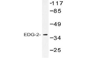 Image no. 1 for anti-Lysophosphatidic Acid Receptor 1 (LPAR1) antibody (ABIN317688) (LPAR1 anticorps)