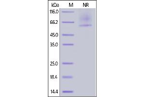 Mouse Glypican 2, His Tag on  under ing (NR) condition. (GPC2 Protein (AA 22-556) (His tag))
