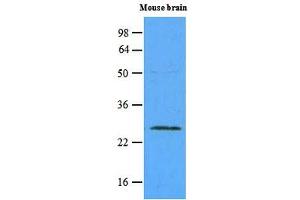 Western blot analysis: The extracts of mouse brain (45ug) were resolved by SDS-PAGE, transferred to NC membrane and probed with anti-human Rab5a (1:500). (RAB5 anticorps)