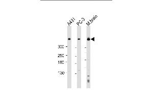 All lanes : Anti-DYNC1H1 Antibody (C-term) at 1:2000 dilution Lane 1: A431 whole cell lysate Lane 2: PC-3 whole cell lysate Lane 3: mouse brain lysate Lysates/proteins at 20 μg per lane.