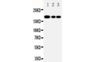 Anti-MRP1 antibody, Western blotting Lane 1: JURKAT Cell Lysate Lane 2: CEM Cell Lysate Lane 3: A549 Cell Lysate (ABCC1 anticorps  (C-Term))