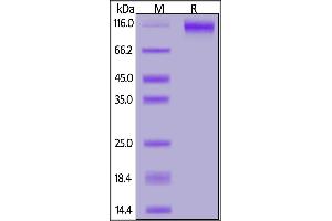 SARS-CoV-2 S1 protein, His Tag on  under reducing (R) condition.