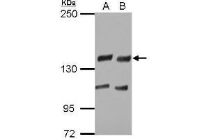 WB Image Sample (30 ug of whole cell lysate) A: H1299 B: HCT116 5% SDS PAGE antibody diluted at 1:5000 (USP8 anticorps)