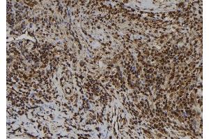 ABIN6259844 and ABIN6277505 at 1/100 staining Human spleen tissue by IHC-P. (AIMP1 anticorps  (Internal Region))