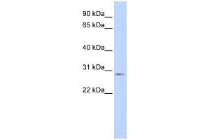 WB Suggested Anti-MYF6 Antibody Titration: 0. (MYF6 anticorps  (Middle Region))