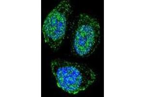 anti-Interleukin 17B (IL17B) (AA 46-74), (Middle Region) antibody