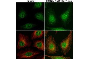 ICC/IF Image Cofilin 1 antibody detects Cofilin 1 protein at cytoplasm and nucleus by immunofluorescent analysis.