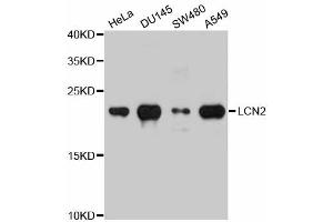 Western blot analysis of extracts of various cell lines, using LCN2 antibody (ABIN5971118) at 1/1000 dilution. (Lipocalin 2 anticorps)