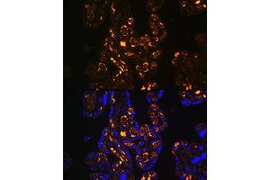Immunofluorescence analysis of Human placenta using ApoER2/ApoER2/LRP8 antibody (ABIN6134224, ABIN6143337, ABIN6143338 and ABIN6214801) at dilution of 1:100.