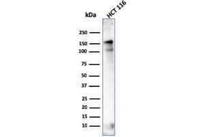 Western Blot Analysis of HCT116 cell lysate using MSH6 Mouse Monoclonal Antibody (MSH6/3086). (MSH6 anticorps  (AA 374-540))