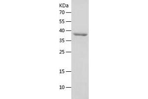 Western Blotting (WB) image for Eukaryotic Translation Initiation Factor 2 Subunit 1 (EIF2S1) (AA 1-315) protein (His tag) (ABIN7122841)