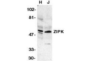 Western blot analysis of ZIP kinase in HeLa (H) and Jurkat (J) whole cell lysates with ZIAP31006PU-N at 1 μg/ml. (DAPK3 anticorps  (Center))