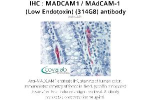Image no. 2 for anti-Mucosal Vascular Addressin Cell Adhesion Molecule 1 (MADCAM1) antibody (ABIN5693628) (MADCAM1 anticorps)