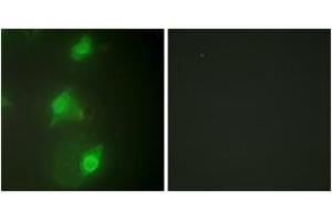 Immunofluorescence analysis of HeLa cells, using AIRE Antibody. (AIRE anticorps  (AA 91-140))
