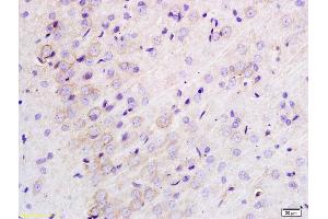 Formalin-fixed and paraffin embedded rat brain labeled with Anti-TLR1 Polyclonal Antibody, Unconjugated (ABIN736373) at 1:200 followed by conjugation to the secondary antibody and DAB staining. (TLR1 anticorps  (AA 101-200))