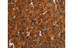 Immunohistochemistry of Human brain  using ENTPD7 Polyclonal Antibody at dilution of 1:40 (ENTPD7 anticorps)