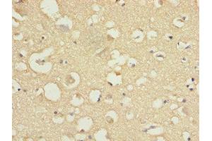 Immunohistochemistry of paraffin-embedded human brain tissue using ABIN7148022 at dilution of 1:100 (COPZ1 anticorps  (AA 1-177))