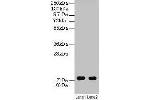 Western blot All lanes: ATP5F1D antibody at 2 μg/mL Lane 1: EC109 whole cell lysate Lane 2: 293T whole cell lysate Secondary Goat polyclonal to rabbit IgG at 1/15000 dilution Predicted band size: 18 kDa Observed band size: 18 kDa