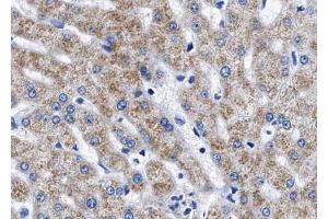 ABIN6267543 at 1/100 staining human liver tissue sections by IHC-P. (Tuberin anticorps  (pThr1462))