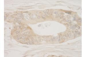 Immunohistochemistry (IHC) image for anti-Ribosomal Protein S6 Kinase, 90kDa, Polypeptide 3 (RPS6KA3) (AA 1-50) antibody (ABIN7449018)