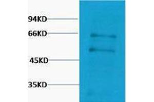 Western Blotting (WB) image for anti-Myc Proto-Oncogene protein (MYC) antibody (ABIN3181293) (c-MYC anticorps)