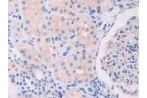 Detection of TLR3 in Human Kidney Tissue using Polyclonal Antibody to Toll Like Receptor 3 (TLR3)