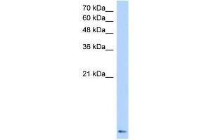 Transfected 293T; WB Suggested Anti-ZNF706 Antibody Titration: 0. (ZNF706 anticorps  (N-Term))