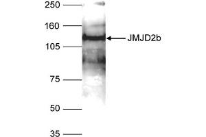 Western Blot of anti-JMJD2b antibody Western Blot results of Rabbit anti-JMJD2b antibody. (KDM4B anticorps  (Internal Region))