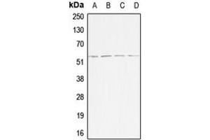 Western blot analysis of ACVR1B expression in HeLa (A), Jurkat (B), SP2/0 (C), H9C2 (D) whole cell lysates. (Activin A Receptor Type IB/ALK-4 anticorps  (Center))