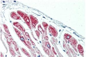 Human Heart (formalin-fixed, paraffin-embedded) stained with DES antibody ABIN396919 at 10 ug/ml followed by biotinylated anti-mouse IgG secondary antibody ABIN481714, alkaline phosphatase-streptavidin and chromogen.