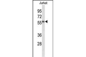 Western blot analysis of SACM1L Antibody (C-term) (ABIN653512 and ABIN2842917) in Jurkat cell line lysates (35 μg/lane). (SACM1L anticorps  (C-Term))