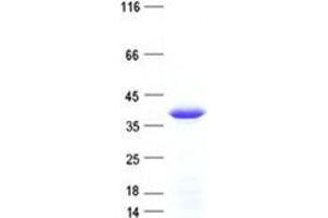 Validation with Western Blot