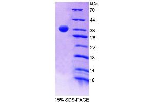 SDS-PAGE analysis of Mouse PNPO Protein.