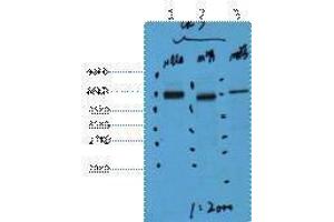 anti-Keratin 7 (KRT7) antibody